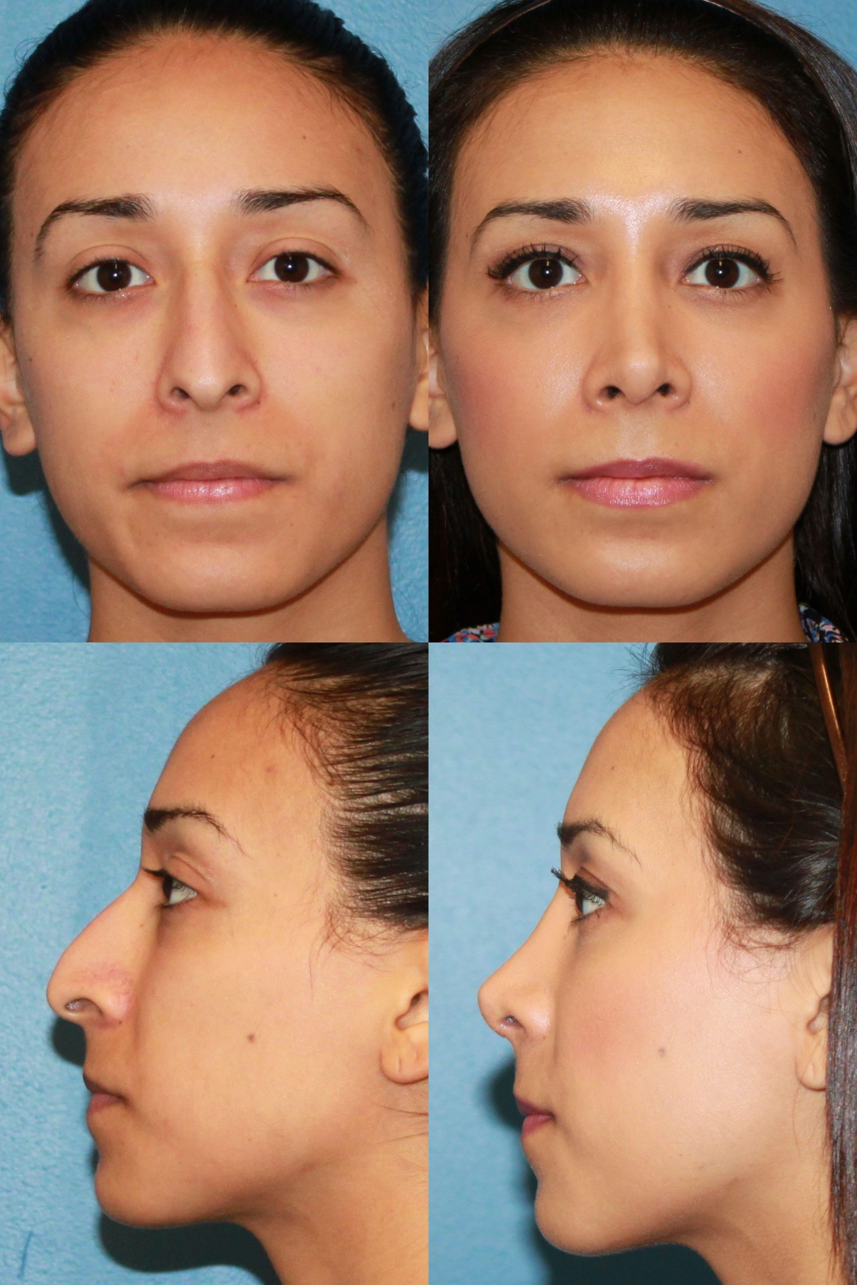 The Visionary Surgeon Who Put Trinidad on the Map – revision rhinoplasty experts.